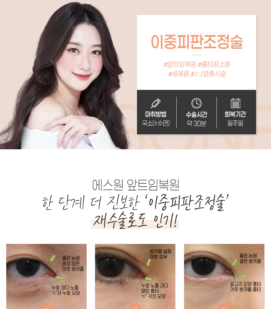 여드름