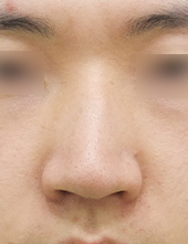 이미지샘플