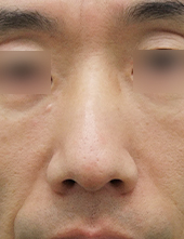 이미지샘플