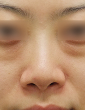 이미지샘플