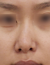 이미지샘플