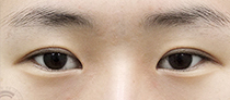 이미지샘플