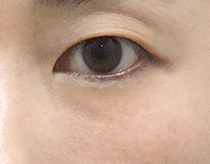 이미지샘플