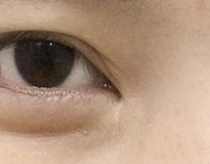 박예0 6개월