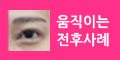 움직이는 전후사례