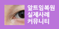 앞트임복원 실제사례 커뮤니티