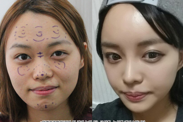 코, 눈수술, 안면윤곽(이마/턱/광대)