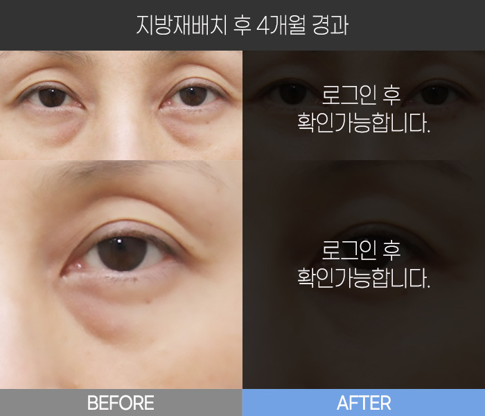 지방 재배치 후 4개월 경과
