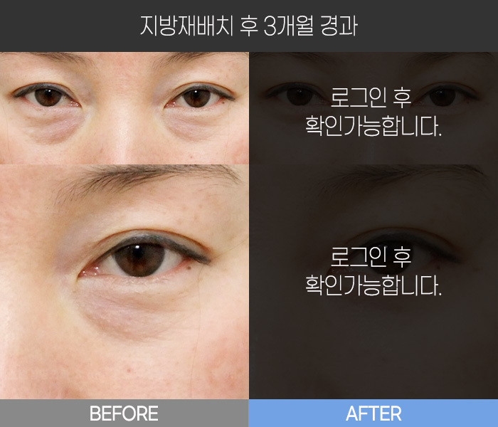 지방 재배치 후 3개월 경과