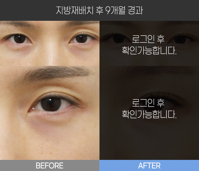 지방 재배치 후 9개월 경과