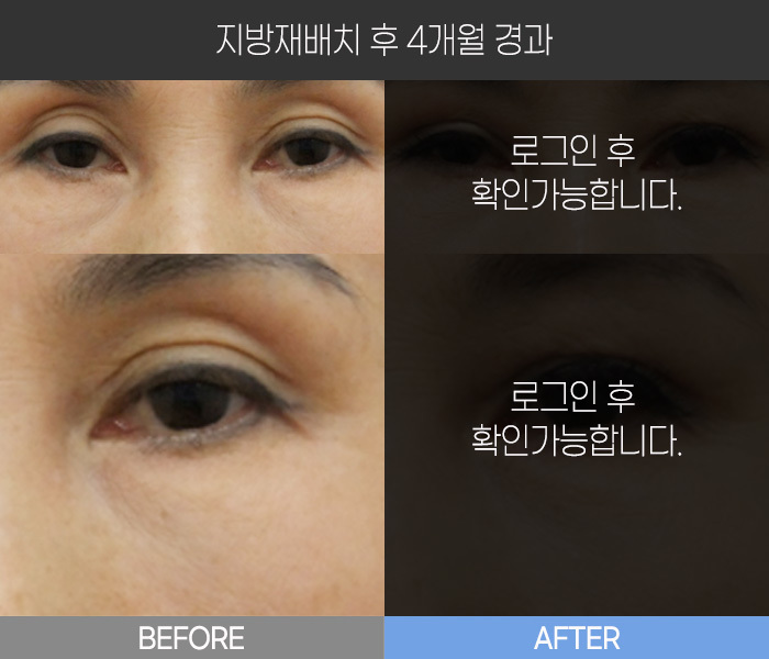 지방 재배치 후 4개월 경과