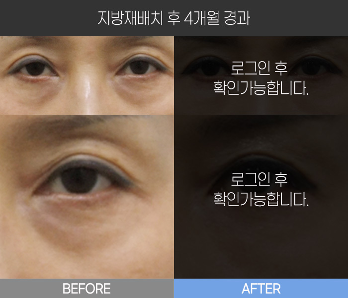 지방 재배치 후 4개월 경과
