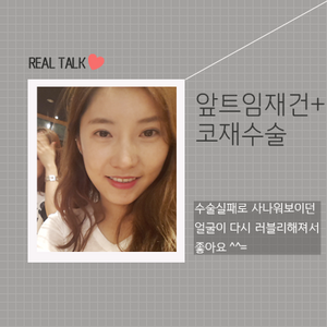 앞트임재건, 코재수술