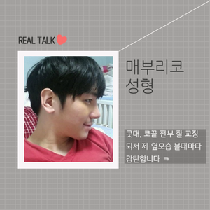 매부리코성형