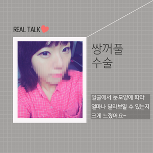 쌍꺼풀 수술